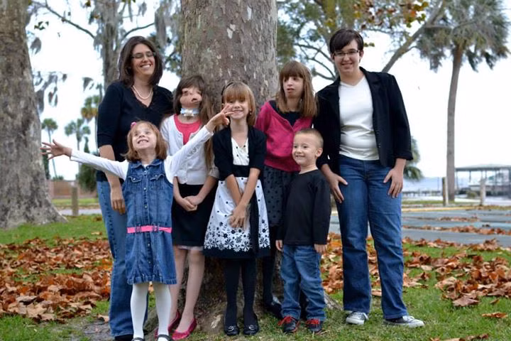 Suc song ky dieu cua be gai khong mat-Hinh-3