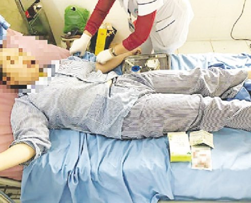 Suy than, ton thuong gan vi tin dung tra giam can