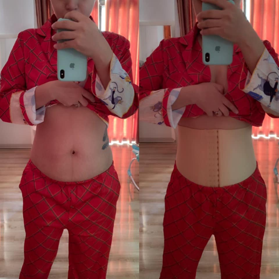 Bi kip lay lai eo thon sau sinh cua Hai Bang khien bac si kinh hai-Hinh-3