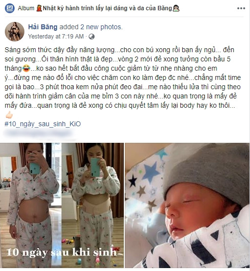 Bi kip lay lai eo thon sau sinh cua Hai Bang khien bac si kinh hai-Hinh-4