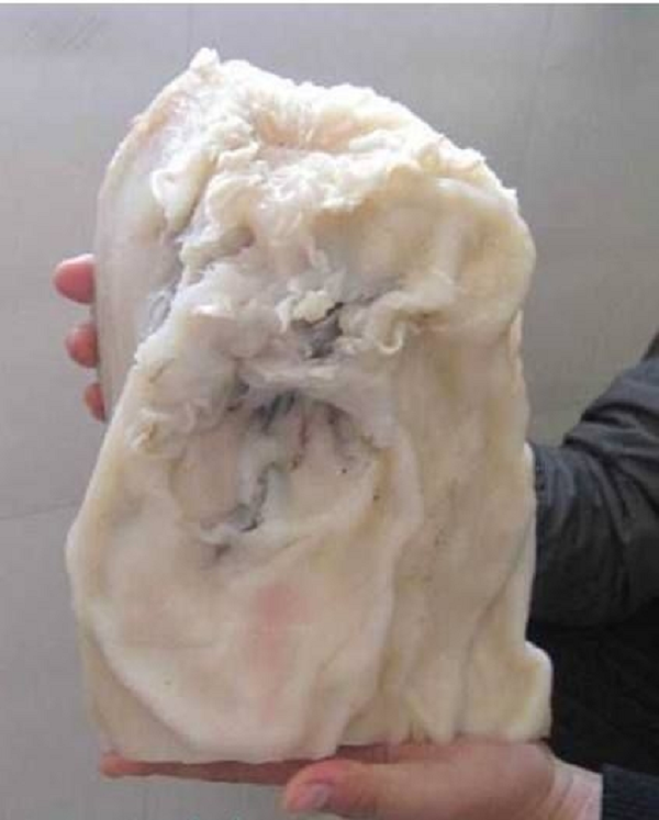 Loài nấm này có khả năng cải thiện tuần hoàn rất tốt, điều tiết estrogen một cách hiệu quả, nâng cao hệ miễn dịch cho con người giúp chống lại nhiều bệnh tật.