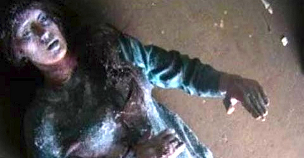 Thậm chí não cũng không thể cứu. Jean sẽ không còn hy vọng nào cả. Điều duy nhất các bác sĩ có thể làm cho cô gái trẻ là đắp các túi giữ ấm quanh người cô để nâng nhiệt độ cơ thể lên, làm tan lớp băng.