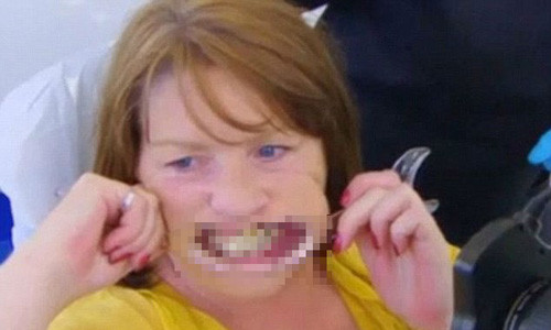 Nguoi phu nu mat ham vi chua rang lung lay bang keo dinh