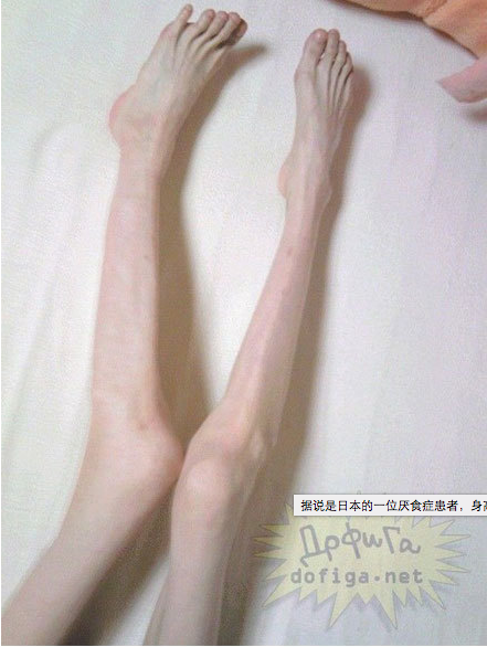 Một số hình ảnh thân hình “gầy khủng khiếp” như thiếu ăn của cô gái Nhật này.