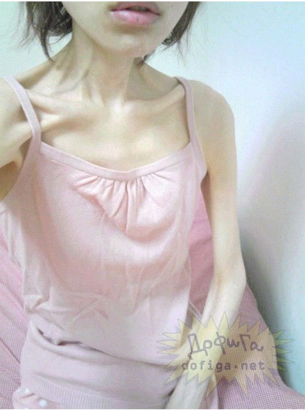 Tất cả các bộ phận trên cơ thể của cô hầu như chỉ là bộ xương thiếu sức sống. Thậm chí nhiều người còn không hiểu tại sao cô ấy có thể duy trì được sức sống với thân hình như vậy.