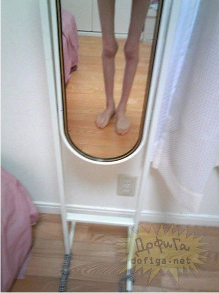 Tuy nhiên theo một nguồn tin, người ta đồn rằng cô gái này bị mắc một chứng bệnh lạ, gần giống với những người bị ung thư xương giai đoạn cuối, nhưng cô khác với những người bị ung thư xương là có thể đi lại bình thường như không hề có bệnh gì mà chỉ là thân hình gầy quá mức mà thôi.