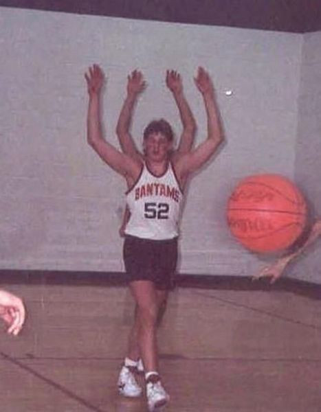 "Dị nhân" bốn tay.