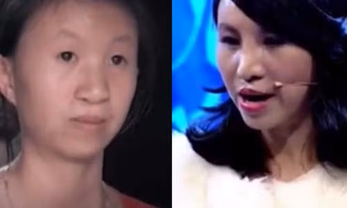 Co gai Hue 22 tuoi lot xac sau phau thuat tham my