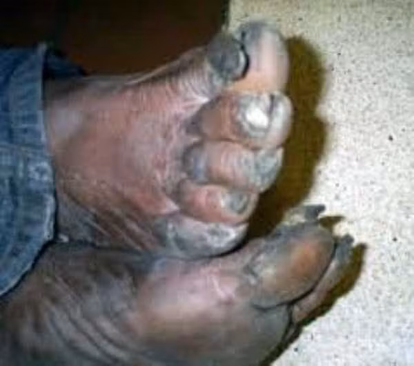 Cả đời không tắm?