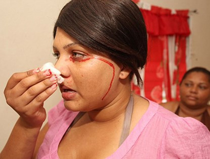 Cô Delfina Cedeno ở Dominica mắc một chứng bệnh rối loạn nghiêm trọng. Cứ mỗi lần khóc là máu lại chảy ra từ mắt, đầu ngón tay và rốn của cô.