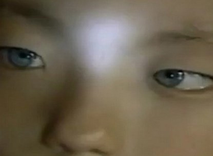 Nhiều nhà khoa học cho rằng có thể mắt cậu bé có chứa Tapetum lucidum – một lớp tế bào bao phủ trước màng mắt, tạo ra màu xanh dương trong bóng tối.