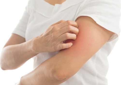 Nhóm nghiên cứu của Tiến sĩ Kupfer đã tiến hành cùng một thí nghiệm ba lần, hai lần ở Hoa Kỳ và một lần ở Trung Quốc, với hơn 1.000 tình nguyện viên. Các tình nguyện viên sẽ được xem một đoạn video kéo dài 90 giây bao gồm các hình ảnh về bọ chét, rệp đêm, muỗi hút máu, vết thương bị nhiễm trùng. Đây đều là những hình ảnh gợi liên tưởng về mầm bệnh và ngoại ký sinh. Tình nguyện viên sau khi xem video sẽ được hỏi về phản ứng cảm xúc và thể chất của mình.