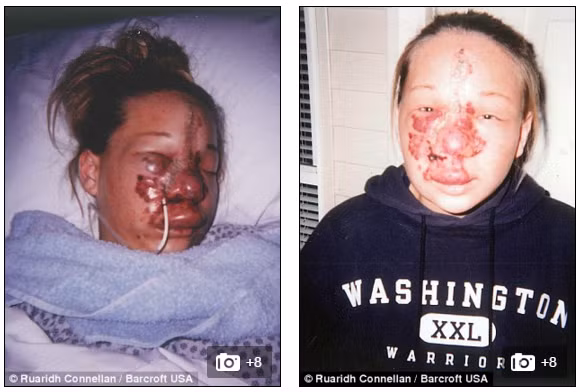 Cô cũng thường xuyên được đưa vào viện cấp cứu trong tình trạng nguy kịch.