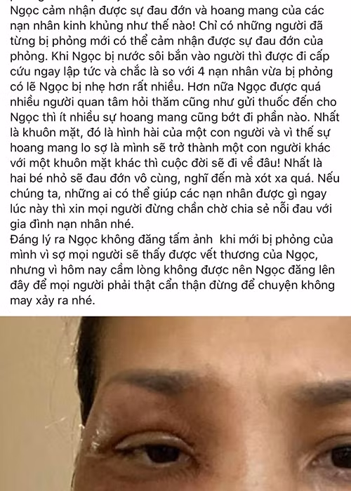 Gương mặt của Hồng Ngọc bị bỏng nặng vào ngày 9/5. Ngoài mặt, ngực và cánh tay của nữ ca sĩ cũng bị ảnh hưởng.
