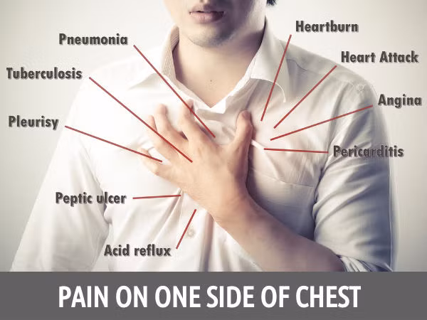 Gãy xương. Đau tức ngực cũng có thể do vết nứt ở xương sườn. Nếu cơn đau xuất hiện sau khi bị tai nạn, nó có thể là do chấn thương ở xương. Thực tế, ngay một cái ôm ghì chặt cũng gây ra cơn đau do nứt xương.