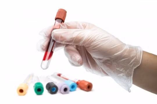 Mọi triệu chứng tiểu ra máu với ba tính chất trên đều phải nghĩ ngay đến khối u ung thư bàng quang và phải tiến tới thực hiện ngay những xét nghiệm cận lâm sàng cần thiết để khẳng định chẩn đoán, không đợi tới khi có triệu chứng tiểu ra máu nhiều, ra máu liên tục mới nghi ngờ ung thư bàng quang. Trên thực tế, cũng có nhiều bệnh nhân đi tiểu ra máu vài lần, sau đó không thấy xuất hiện triệu chứng này, đến vài tuần sau mới thấy ra máu lại.