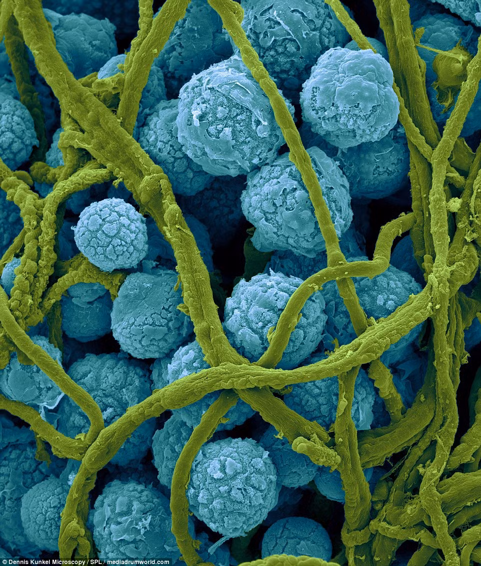 Thú cưng. Epicoccum nigrum là loại nấm ký sinh thường được tìm thấy trong không khí, đất, thức ăn phân hủy, các sản phẩm dệt may và trên một số loại động vật. Loại nấm này cũng có thể gây dị ứng ở người.