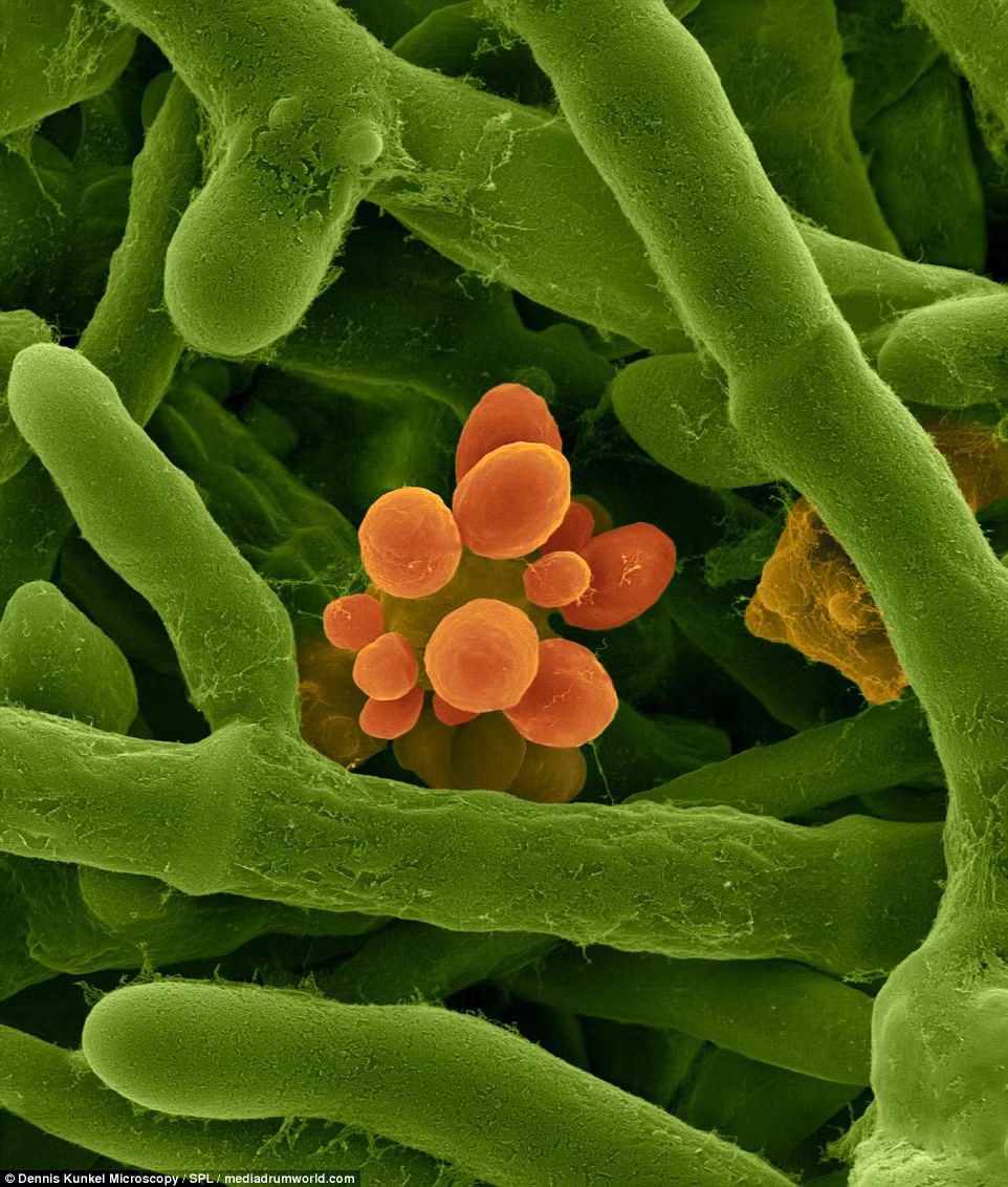 Memnoniella echinata là loại nấm mốc thuộc loại nấm men, phát triển trong mọi điều kiện môi trường nhưng phát triển mạnh nhất ở những nơi ẩm ướt.