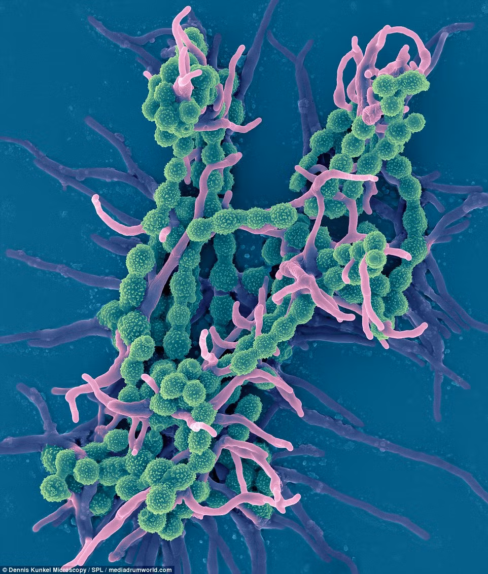 Tường nhà cũng là nơi ẩn nấp cực kỳ thuận lợi cho các vi khuẩn. Cụ thể, vi khuẩn Scopulariopsis brevicaulis thường được tìm thấy trong đất, loại nấm này có thể gây ra căn bệnh nhiễm trùng móng tay ở người.