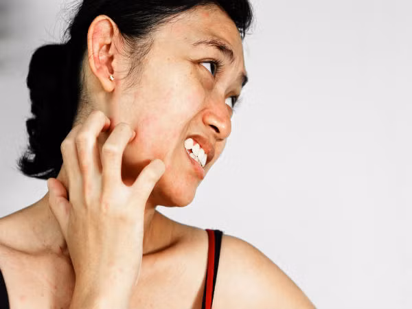 Bênh vảy nến. Khi da quá khô hoặc có bong vảy, đây có thể là dấu hiệu bạn đang mắc các bệnh về da như vảy nến, bệnh chàm.