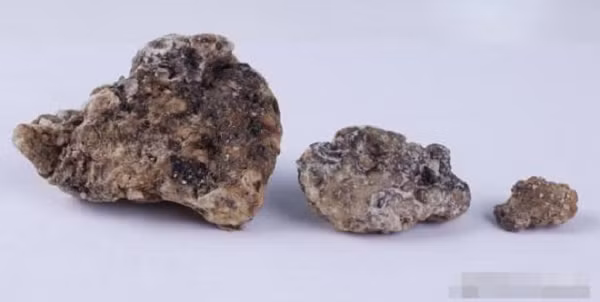 Các chuyên gia vẫn chưa thể lý giải tại sao long diên hương phổ biến hơn ở nam bán cầu và tại sao chỉ cá nhà táng đực mới sản sinh ra nguyên liệu này. Điều khiến long diên hương trở nên ngày càng quý giá và khan hiếm là số lượng cá nhà táng sụt giảm mạnh, hiện nay chỉ còn khoảng 350.000 con so với 1,1 triệu con trước khi bị đánh bắt.