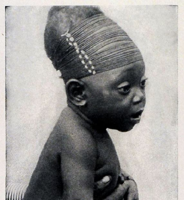 Khi đó, người cổ đại sẽ quấn đầu và buộc các tấm gỗ để làm cho hộp sọ của trẻ sơ sinh có hình dạng mong muốn. Loại "phẫu thuật" này được thực hiện trong thời kỳ sơ sinh, khi đầu của chúng tương đối mềm nên dễ biến dạng.