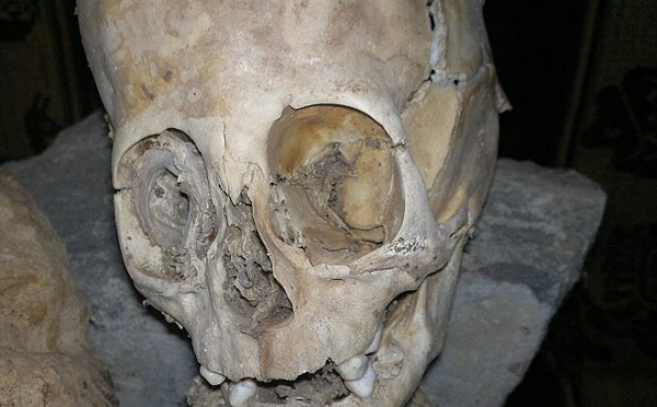 Bộ xương được tìm thấy bởi Renato Davila Riquelme - một nhân viên làm việc cho bảo tàng Privado Ritos Andinos tại Cusco, phía đông nam Peru. Điều khiến phát hiện này được quan tâm là hộp sọ nhìn không giống với con người.