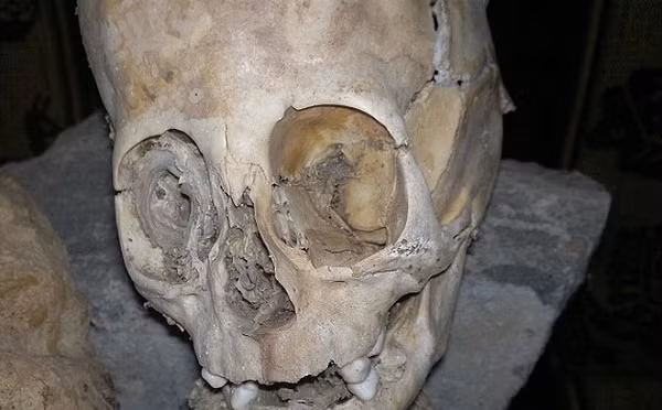 Bộ xương được tìm thấy bởi Renato Davila Riquelme - một nhân viên làm việc cho bảo tàng Privado Ritos Andinos tại Cusco, phía đông nam Peru. Điều khiến phát hiện này được quan tâm là hộp sọ nhìn không giống với con người.