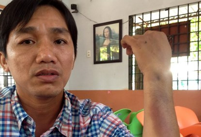 Con trai Giam doc Cong an Ca Mau danh ca phu nu