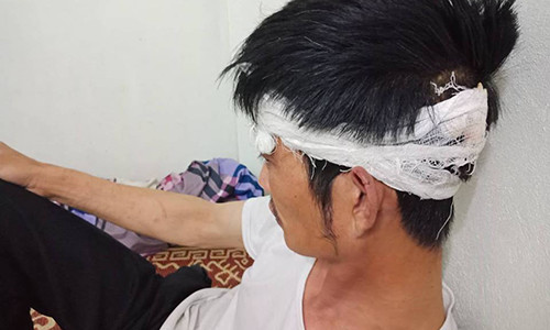 Anh Điềm kể lại vụ việc với PV.