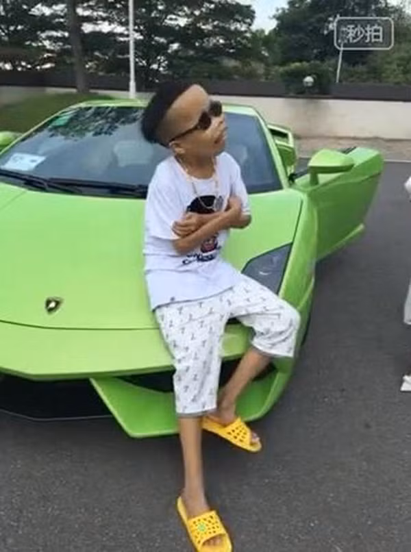 Khi mới nổi tiếng, đại gia xấu lạ Trần Sơn được lan truyền là con trai của Trần Dư Hải, tổng giám đốc của Vạn Khoa, một công ty lớn chuyên về vàng bạc ở Trung Quốc. Sinh ra đã mắc một chứng bệnh lạ, dù năm nay 23 tuổi nhưng Trần Sơn lại có thân hình, vóc dáng của một đứa trẻ, ngoài ra khuôn mặt của chàng trai này cũng bị biến dạng rất dị hợm, thậm chí còn bị mô tả là "nửa người nửa ma". Sở dĩ, chàng trai này có khuôn mặt xấu, kỳ dị là do mắc một chứng bệnh tên thalassemia.