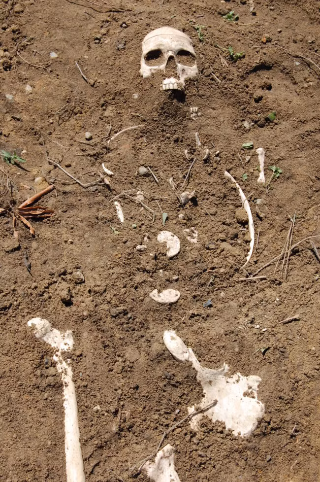 Đây là một bộ xương nhưng khi được các chuyên gia khám nghiệm, cảnh sát vẫn có thể biết được một số chi tiết về nguyên nhân chết hoặc thời gian chết. (Theo Viral)