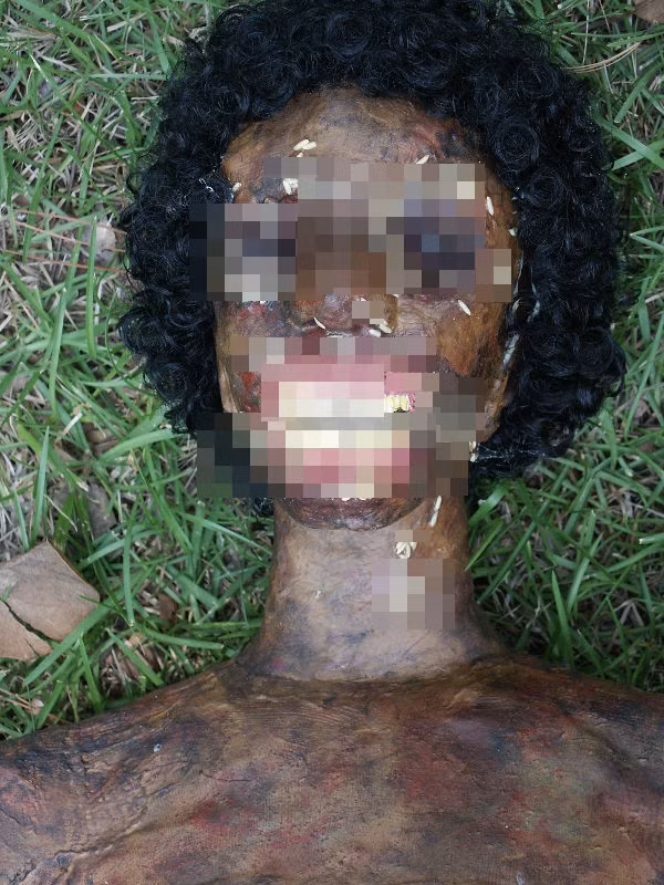 Xác chết kinh hoàng này là của một người phụ nữ bị bắn vào đầu bởi một khẩu súng ngắn. Sau khi xác định nguyên nhân ban đầu, các chuyên gia pháp y vẫn phải tiến hành mổ tử thi để xác định chính xác nguyên nhân của cái chết, không bỏ lỡ bất cứ manh mối nào. (Theo Viral)