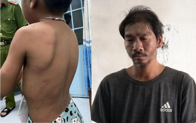  Cha liên tiếp hành hạ con ruột gây thương tích. Công an huyện An Biên (Kiên Giang) vừa khởi tố bị can, bắt tạm giam Lương Văn Luận (SN 1985, xã Đông Thái,) về hành vi Ngược đãi, hành hạ con ruột. Nạn nhân là cháu L.H.T. (SN 2016). Điều tra cho thấy, Luận thường xuyên có hành vi đánh đập, hành hạ bé T. Ngày 22/6, Luận đã dùng thanh sắt đánh vào đầu, mặt, tay, lưng của bé T. gây thương tích nhưng được người dân can ngăn và đưa bé T. đến trạm y tế điều trị. Sau khi bị lập biên bản xử phạt, Luận không chấp hành còn tiếp tục đánh đập hành hạ bé T.