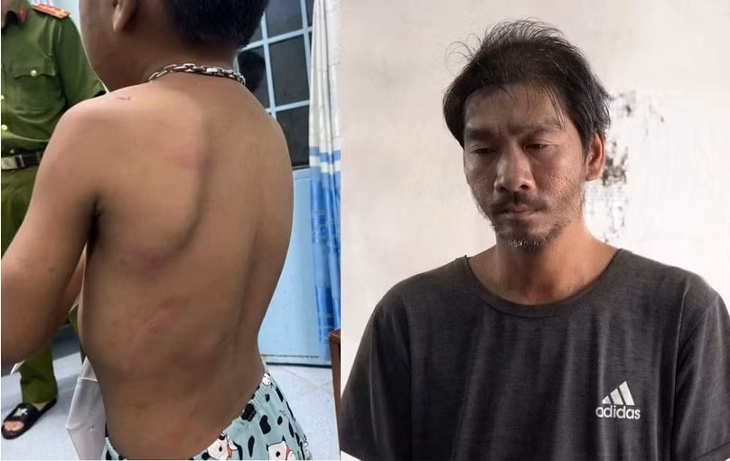  Cha liên tiếp hành hạ con ruột gây thương tích. Công an huyện An Biên (Kiên Giang) vừa khởi tố bị can, bắt tạm giam Lương Văn Luận (SN 1985, xã Đông Thái,) về hành vi Ngược đãi, hành hạ con ruột. Nạn nhân là cháu L.H.T. (SN 2016). Điều tra cho thấy, Luận thường xuyên có hành vi đánh đập, hành hạ bé T. Ngày 22/6, Luận đã dùng thanh sắt đánh vào đầu, mặt, tay, lưng của bé T. gây thương tích nhưng được người dân can ngăn và đưa bé T. đến trạm y tế điều trị. Sau khi bị lập biên bản xử phạt, Luận không chấp hành còn tiếp tục đánh đập hành hạ bé T.