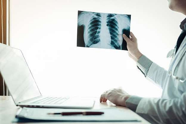 8. Phổi là cơ quan duy nhất trong cơ thể con người có thể nổi trên mặt nước.