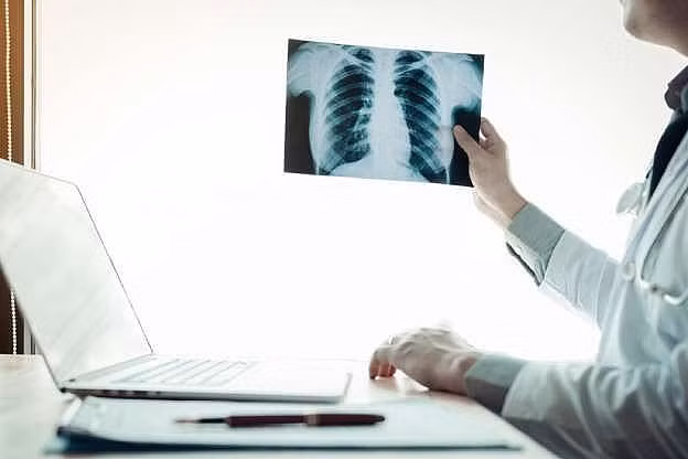 8. Phổi là cơ quan duy nhất trong cơ thể con người có thể nổi trên mặt nước.