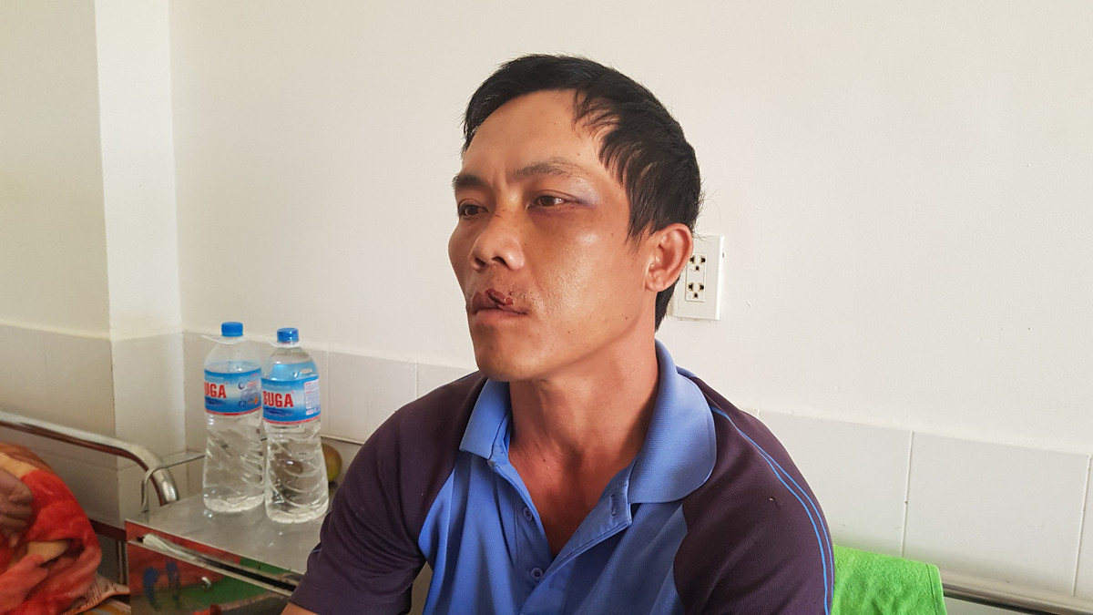 Sau sự việc, Công ty Cổ phần Quang điện Phú Khánh (chủ đầu tư dự án Điện mặt trời Xuân Thọ) đã thống nhất đình chỉ công tác và thu hồi quyết định bổ nhiệm chức vụ Phó Tổng Giám đốc Công ty Cổ phần Quang điện Phú Khánh đối với ông Nguyễn Văn Biền.