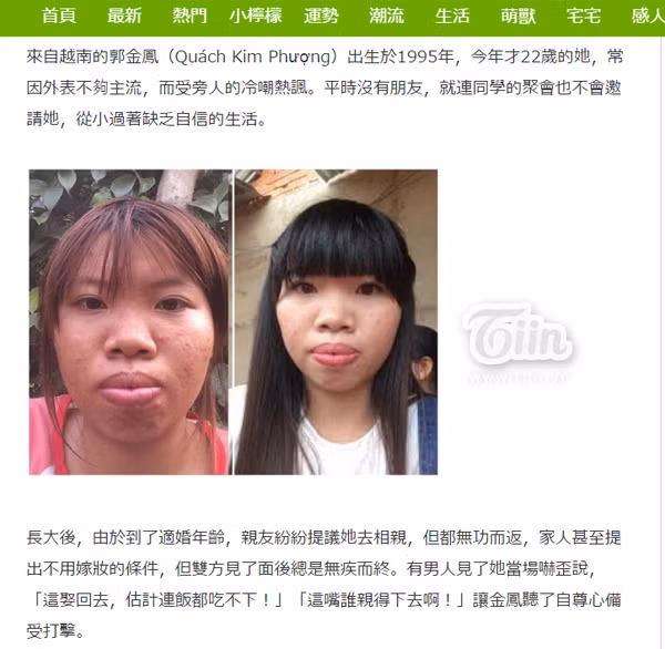 Quách Kim Phượng là một trong những cái tên được dư luận, truyền thông và cộng đồng mạng Việt chú ý nhất thời gian gần đây. Bởi lẽ, bà mẹ một con với nhan sắc bị ví như ' Thị Nở tái sinh' này đã chi 150 triệu đồng để phẫu thuật thẩm mỹ, trùng tu nhan sắc. Điều bất ngờ là sau đó, cuộc sống của cô nàng đã sang một trang mới với nhiều cơ hội mới trong cuộc sống.