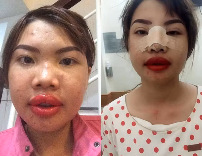 Ngay lập tức, câu chuyện về bà mẹ đơn thân xấu như 'Thị Nở tái sinh' quyết chí đập đi xây lại để tìm hạnh phúc mới nhận được sự quan tâm lớn của dân mạng Trung Quốc.