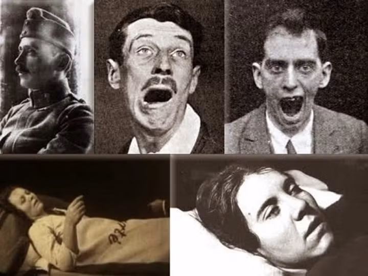 Mặc dù tác dụng của thuốc không kéo dài lâu, nhưng cũng khiến tình trạng bệnh của những người này thuyên giảm. Dự án nghiên cứu này sau đó được đưa vào một cuốn sách và một bộ phim.