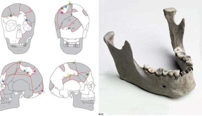 Các nhà nghiên cứu đặt biệt danh cho người đàn ông thời Đồ đá trên là "Người Vittrup". Người này sống vào khoảng năm 3300 trước Công nguyên - 3100 trước Công nguyên.