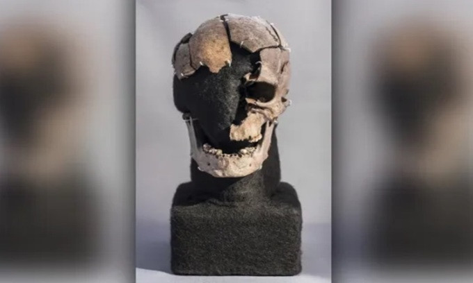 Cách đây hơn 1 thập kỷ, người ta phát hiện một bộ hài cốt người đàn ông vùi xác hơn 5.000 năm trong đầm lầy than bùn ở Đan Mạch. Sau nhiều năm nghiên cứu, phân tích xác ướp, các chuyên gia đã giải mã được bí mật về cái chết của người này.