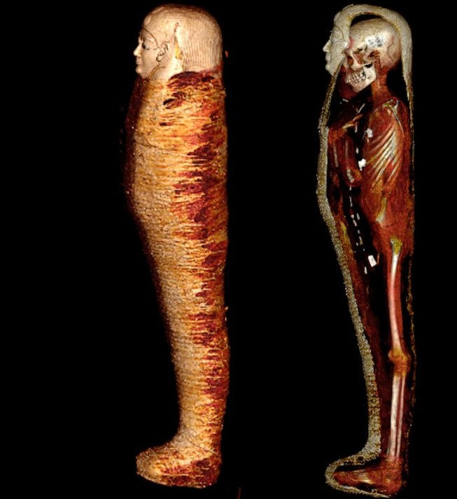 Theo các chuyên gia, những người thợ ướp xác đã lấy ra toàn bộ nội tạng trước khi tiến hành quy trình bảo quản thi hài thiếu niên trên.