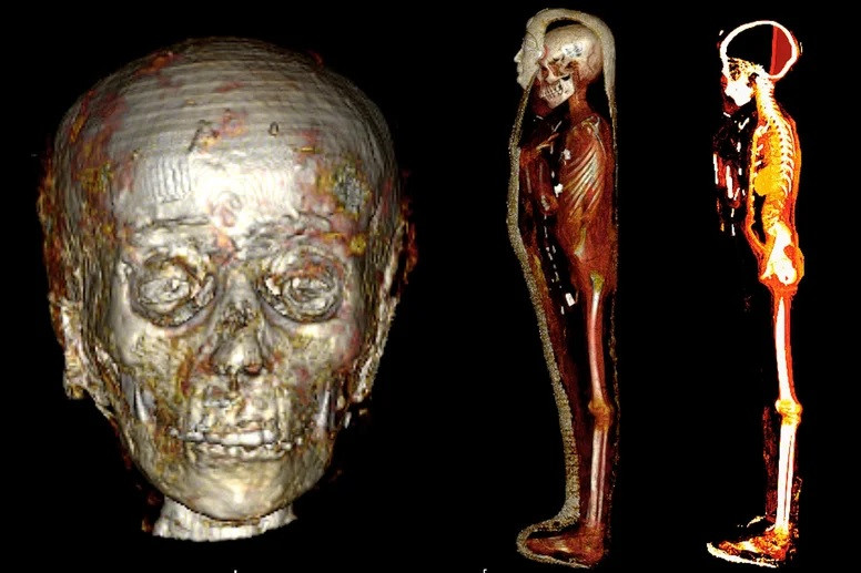 Nhóm chuyên gia cũng tìm thấy chiếc lưỡi vàng bên trong xác ướp “cậu bé vàng”. Theo bà Saleem, người Ai Cập cổ đại đặt chiếc lưỡi vàng trong thi thể người quá cố nhằm giúp giúp linh hồn có thể nói chuyện ở thế giới bên bia.