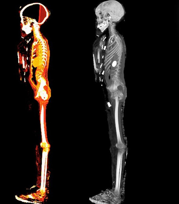 Các nhà nghiên cứu cho hay đa số bùa hộ mệnh được làm bằng vàng và số còn lại làm từ đá quý, đất nung hoặc sứ. Chúng được chôn cùng cậu bé nhằm bảo vệ linh hồn người quá cố ở thế giới bên kia.