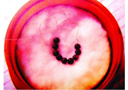 Trong thời gian ở đây, Ngài đã được nhân dân trong làng hết lòng giúp đỡ. Vì vậy, Ngài đã đặt tên cho làng là Hương Đại (túi thơm). Trước khi xuất quân, Vua Trần Nhân Tông tới chùa Minh Khánh, lập đàn tế Phật, tế trời đất với quyết tâm tiêu diệt giặc Nguyên Mông. Trong ảnh là 9 viên xá lợi được cho là của Phật Hoàng Trần Nhân Tông, được lưu giữ ở chùa Minh Khánh.