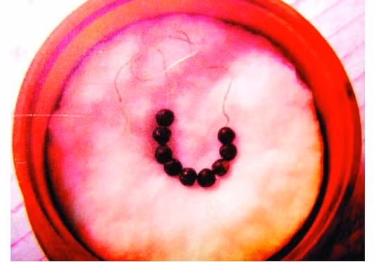 Trong thời gian ở đây, Ngài đã được nhân dân trong làng hết lòng giúp đỡ. Vì vậy, Ngài đã đặt tên cho làng là Hương Đại (túi thơm). Trước khi xuất quân, Vua Trần Nhân Tông tới chùa Minh Khánh, lập đàn tế Phật, tế trời đất với quyết tâm tiêu diệt giặc Nguyên Mông. Trong ảnh là 9 viên xá lợi được cho là của Phật Hoàng Trần Nhân Tông, được lưu giữ ở chùa Minh Khánh.