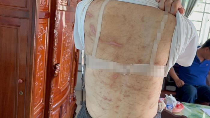 Hai Duong: Hoi Phu nu vao cuoc vu thai phu o Kien Giang to chong bao hanh-Hinh-2