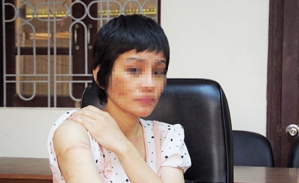 Thai phu Kien Giang bi bao hanh: Chong thua nhan danh vo do nghi ngoai tinh-Hinh-3